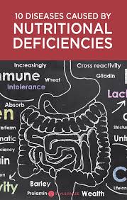 10 Common Nutritional Deficiency Diseases Symptoms Causes