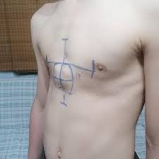 Pektus Turkiye Health Beauty 65 Photos Facebook