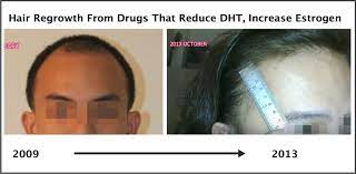 In the present study, we show that estrogen induced apoptosis of precortex cells and caused. Exactly How Trans Hormone Replacement Therapy Regrows Hair Photos