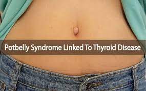 Pin On Thyroid Health