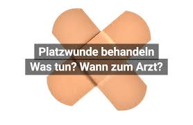 Platzwunde Erste Hilfe Und Wann Zum Arzt Praktischarzt