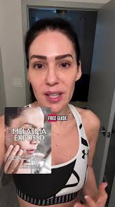 Effective Melasma Treatment: Achieve Clear Skin