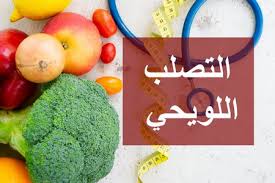 جمعية التصلب اللويحي في كندا تدعم لتجربة مادة metformin على مرضى التصلب اللويحي الشباب. Ù…Ø§Ø°Ø§ ÙŠØ£ÙƒÙ„ Ù…Ø±ÙŠØ¶ Ø§Ù„ØªØµÙ„Ø¨ Ø§Ù„Ù„ÙˆÙŠØ­ÙŠ Ø§Ù„Ù†Ø¸Ø§Ù… Ø§Ù„ØºØ°Ø§Ø¦ÙŠ Ø§Ù„Ù…Ù†Ø§Ø³Ø¨ Ù„Ù…Ø±Ø¶Ø§Ù‡ Ù…ÙˆÙ‚Ø¹ Ø§Ù„Ù…Ø²ÙŠØ¯