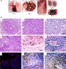 Glioblastoma is an aggressive cancer of the brain. A Genetic Mouse Model For Metastatic Lung Cancer With Gender Differences In Survival Oncogene