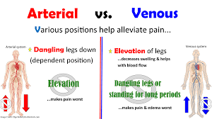Position deviations in 2d or 3d are computed from the difference between the basic and actual x, y, z position of the feature. Peripheral Arterial Disease Vs Registerednursern Com Facebook