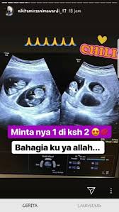 Gambaran usg janin perempuan usia kehamilan 29 minggu 3 hari youtube. Nikita Mirzani Bagikan Hasil Usg Bayi Kembar Dapatkah Gen Kembar Diturunkan Semua Halaman Intisari
