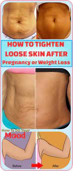 Pin On Skin Care Tips Trick