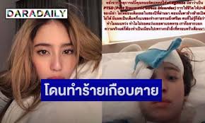 มีล่า จามิล่า เผยเรื่องราวสุดบอบช้ำหลังเก็บมานาน ถูกน้องชายแท้ๆ เอามีดกระหน่ำแทงหัว! Bjfqeb Bd5d1om