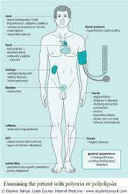 Image result for Polyuria