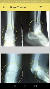It's a series of different moves that together work to make a layer of detail transparent to expose the details behind it. Musculoskeletal X Rays All In 1 Pour Android Telechargez L Apk
