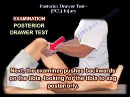 Image result for PCL Sulcus Test