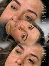 Hey everyone! I now have a clinic in Timaru operating out of Skin Deep!  Would love to see some of you up there. I have a lot of clients in Oamaru  who