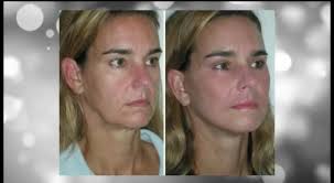 La Dra. Sandra List nos cuenta todo...