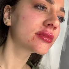 @dramirakhalil's video Tweet