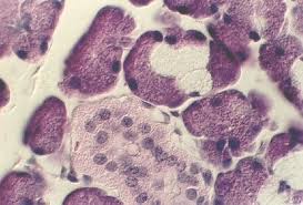 Image result for Dissotis glandulosa