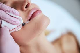 Lip Correction | Alexandra Aesthetics