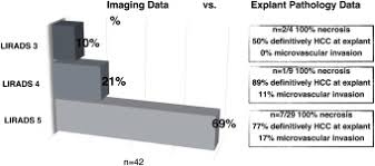 3 joint department of medical imaging, university of toronto, toronto, canada. Li Rads 4 Or 5 Categorization May Not Be Clinically Relevant For Decision Making Processes A Prospective Cohort Study Sciencedirect