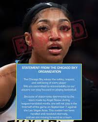 SHOCKING NEWS: Sophie Cunningham explains why she doesn't wear a bra  without worrying about wardrobe malfunction and fans are shocked by this…  See more:: https://autulu.com/p9af