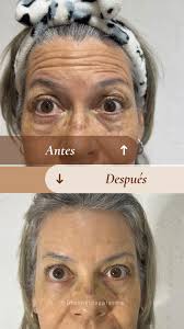 ✨ Resultados que hablan por sí solos ✨, luce una piel más firme, luminosa y  fresca., Recupera tu belleza natural y vuelve a amar lo que ves en el  espejo 💖., 📲 Agenda tu valoración hoy., #pielradiante ...