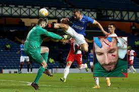This will include the date, location and the two teams involved as well as a link. Slavia Prague Goalkeeper Ondrej Kolar Suffers Skull Fracture After Gruesome Kemar Roofe Challenge Glasgow Times