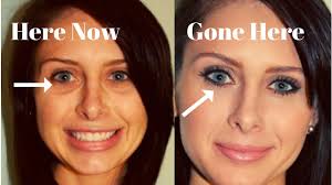 Check spelling or type a new query. How To Use Makeup To Hide Bags Under Eyes Saubhaya Makeup