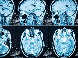 Image result for Incidental Imaging Finding