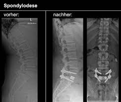 Leistungsspektrum Wirbelsaulenchirurgie Koln Wirbelsaulenchirurgie Des Severinsklosterchens
