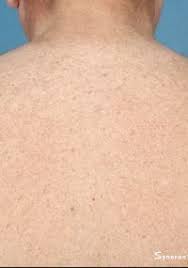 100 simsbury road, suite 205. Laser Hair Removal Fairfield County Connecticut