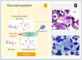 Ijms Free Full Text A Review Of Gaucher Disease Pathophysiology Clinical Presentation And Treatments Html