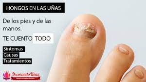 En que parte se ubica el higado. Https Xn Decorandouas Jhb Net Hongos En Las Unas