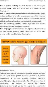 Lenfoma çağın hastalıklarından bir tanesidir. Thd Lenfoma Lenfoma Hasta Kitapcigi 1 Pdf Ucretsiz Indirin