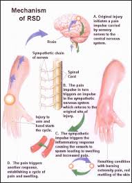 Pin On Physical Therapy