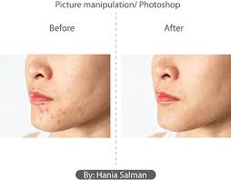 Spot Healing Photoshop Editing Projects :: Photos, videos, logos,  illustrations and branding :: Behance