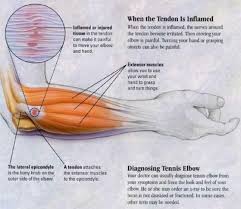 Pin On Joint Pain Relief
