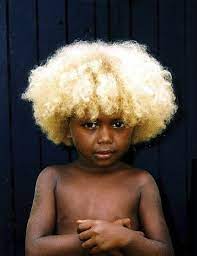 An Island Full Of 100 Natural Un Mixed Black Blondes The People Of Soloman Island Melanesian Black And Blonde Melanesian People Beautiful Children
