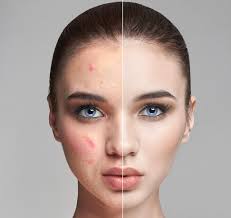 Tu también puedes transformar tu piel con cosméticos en línea: Conoce