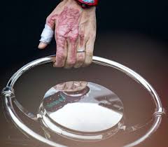 In 2020, lewis hamilton won the british grand prix on three wheels after a tire fell apart on the. Romain Grosjean What To Know About His Hand And Formula 1 Crash