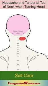 Self Care Headache And Tender At Top Of Neck When Turning Head Integrative Works Trigger Points Headache Natural Remedies For Migraines