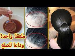 محلول حب رشاد أقسم بالله لن يتوقف شعرك عن النمو بغزارة دون توقف ولن يتساقط بعد اليوم ينبت الفراغات Youtube Facial Massage Hair Wrap Hair