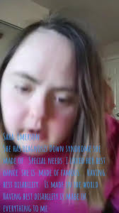 ダウン障害可愛い女子モデル