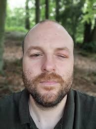 Barnard Pest Control