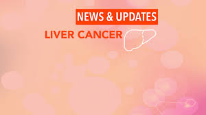 Liver cancer is the growth and spread of unhealthy cells in the liver. Antiviral Therapy May Reduce The Risk Of Tumor Recurrence In Hbv Cancerconnect