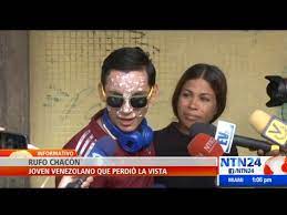 Join facebook to connect with êêl älë and others you may know. Rufo Chacon Venezolano Que Quedo Ciego Tras Ser Herido Con Perdigon Pide Ayuda Para Volver A Ver Youtube