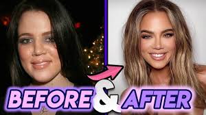 Discover images and videos about khloe kardashian from all over the world on we heart it. Khloe Kardashian Before After Updated Shocking 2020 Transformation Youtube