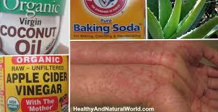 It also looks at the symptoms and causes of the condition. How To Get Rid Of Eczema 13 Natural Remedies Backed By Research