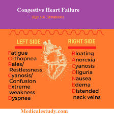 Congestive Heart Failure Signs And Symptoms Cardiac