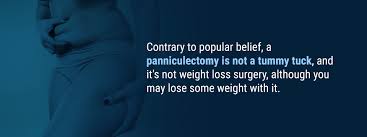 On the other hand, a panniculectomy is usually labeled as a reconstructive procedure, which insurance companies are more likely to pay for. Excess Skin Fat Removal Surgery Panniculectomy Sprsi