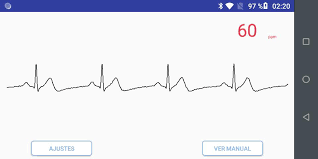 App gratuita, disponible para iphone / ipad y android. Ecg Anywhere For Android Apk Download