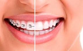 See more ideas about perfect smile, dental clinic, dental. Perfect Smile Dental Care Inicio