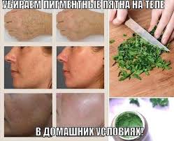 как избавиться от пигментных пятен на лице в домашних условиях Kak Ubrat Pigmentnye Pyatna Na Tele V Domashnih Usloviyah Gorgeous Skin Beauty Health